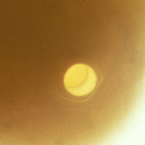 IMG - Pearl Microscope View 1 13533 496x496